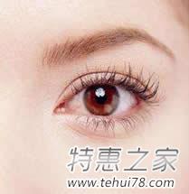 怎样才能有效的去除眼角皱纹，如何防止皱纹产生